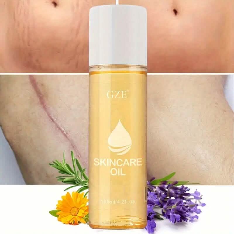 Advanced Stretch Mark Oil with Vitamin E Wellness - DailySale