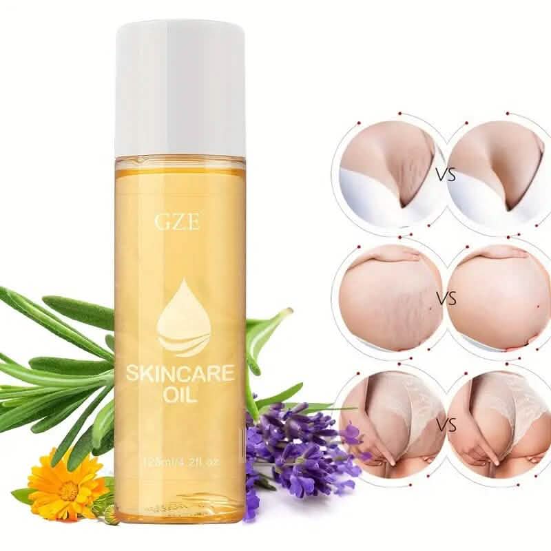 Advanced Stretch Mark Oil with Vitamin E Wellness - DailySale