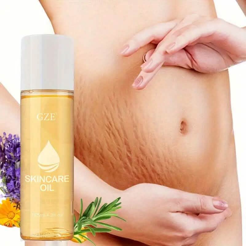 Advanced Stretch Mark Oil with Vitamin E Wellness - DailySale
