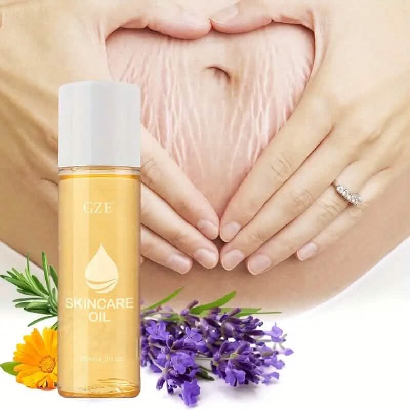 Advanced Stretch Mark Oil with Vitamin E Wellness - DailySale