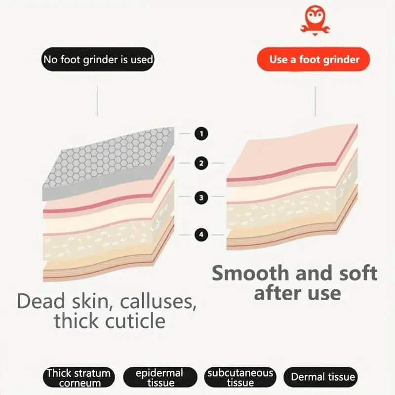 Automatic Vacuum Cleaner and Foot Grinder Beauty & Personal Care - DailySale