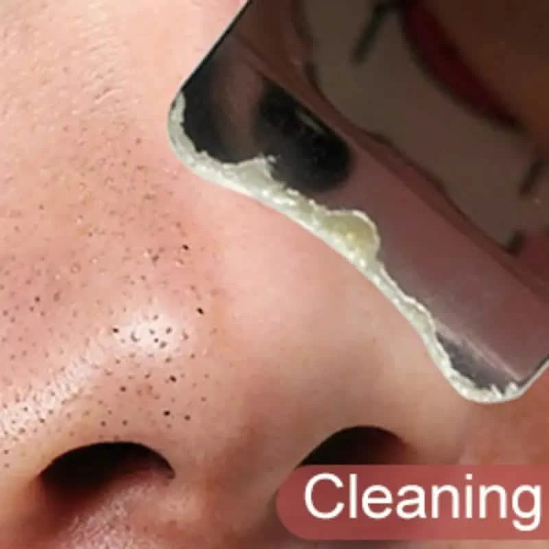 Facial Blackhead Removal Pore Cleaning Skin Scraper Tool Beauty & Personal Care - DailySale