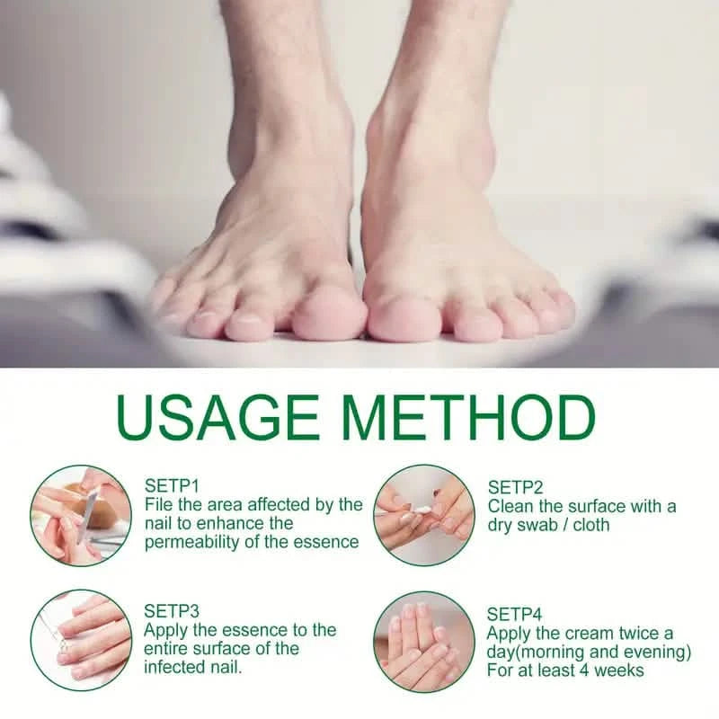 Ginger Nail Care Liquid Onychomycosis Fungus Repair Hand and Foot Nail Care Beauty & Personal Care - DailySale