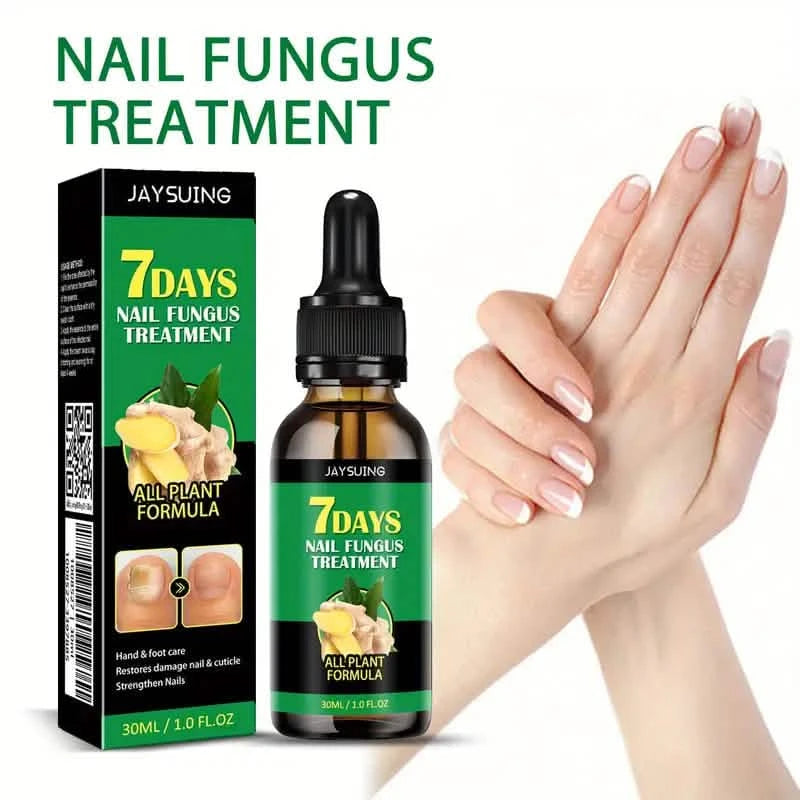 Ginger Nail Care Liquid Onychomycosis Fungus Repair Hand and Foot Nail Care Beauty & Personal Care - DailySale