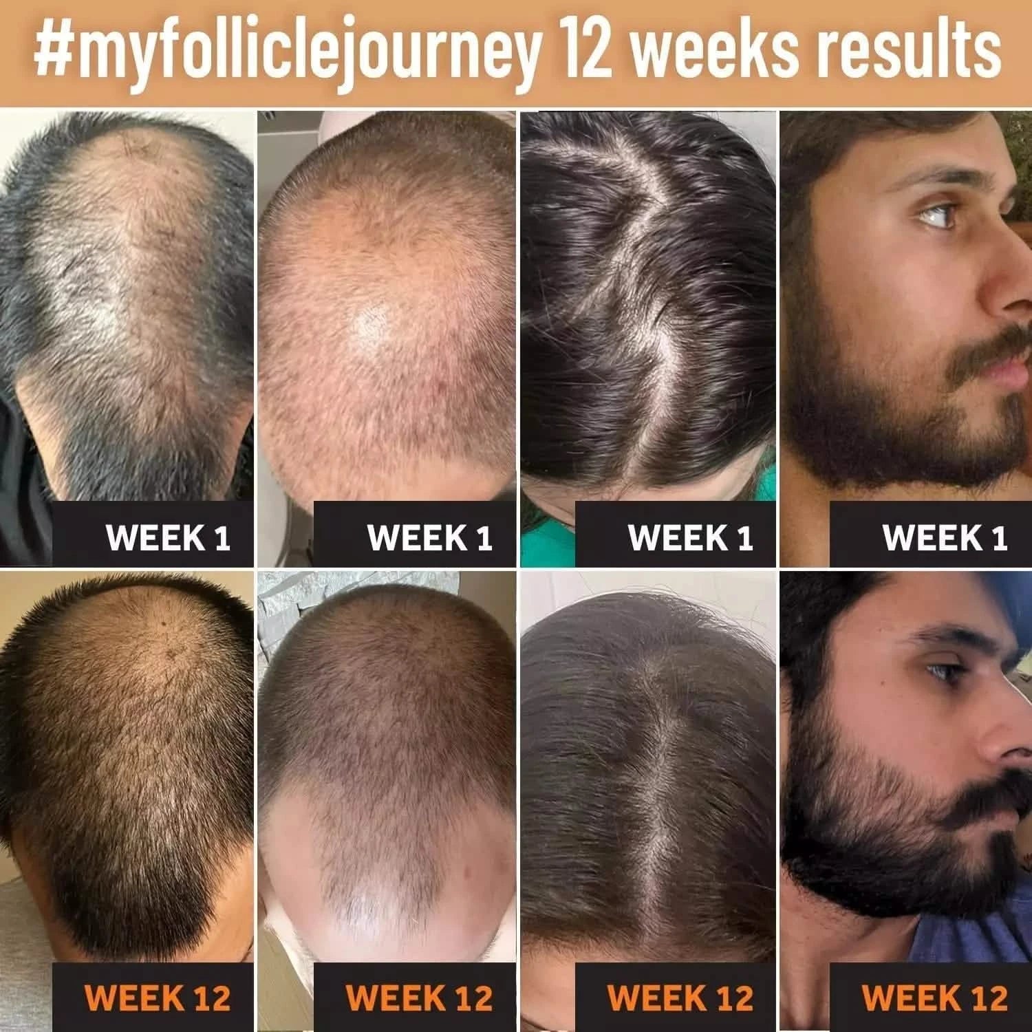 Hair Oil-Biotin Serum Treatment for Stronger Thicker Longer Hair Beauty & Personal Care - DailySale