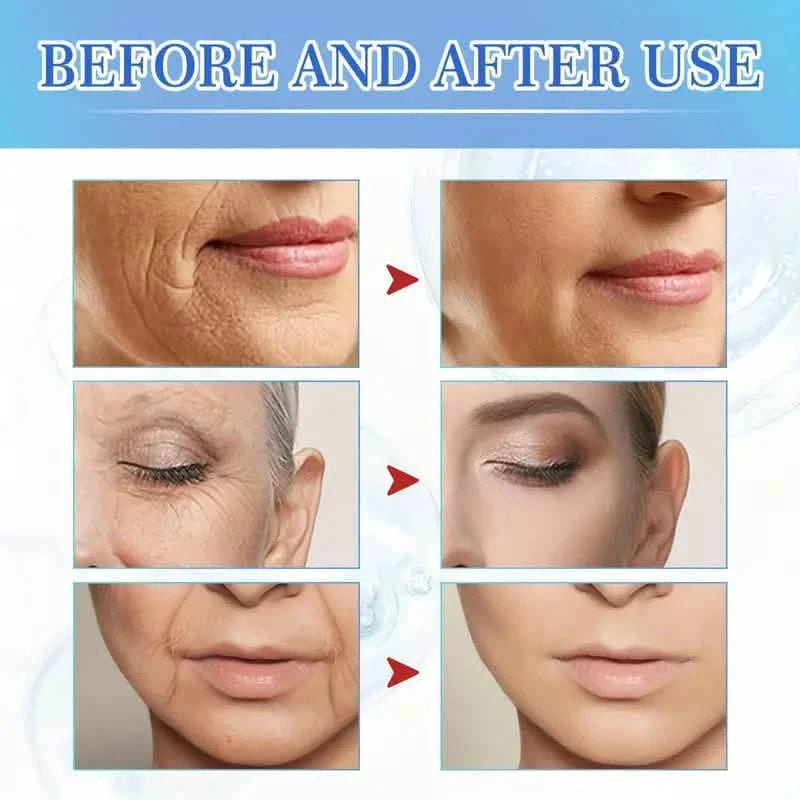 Intensive Anti Aging Botox Facial Serum - Plumps, Firms, Smooths Fine Lines and Wrinkles Beauty & Personal Care - DailySale