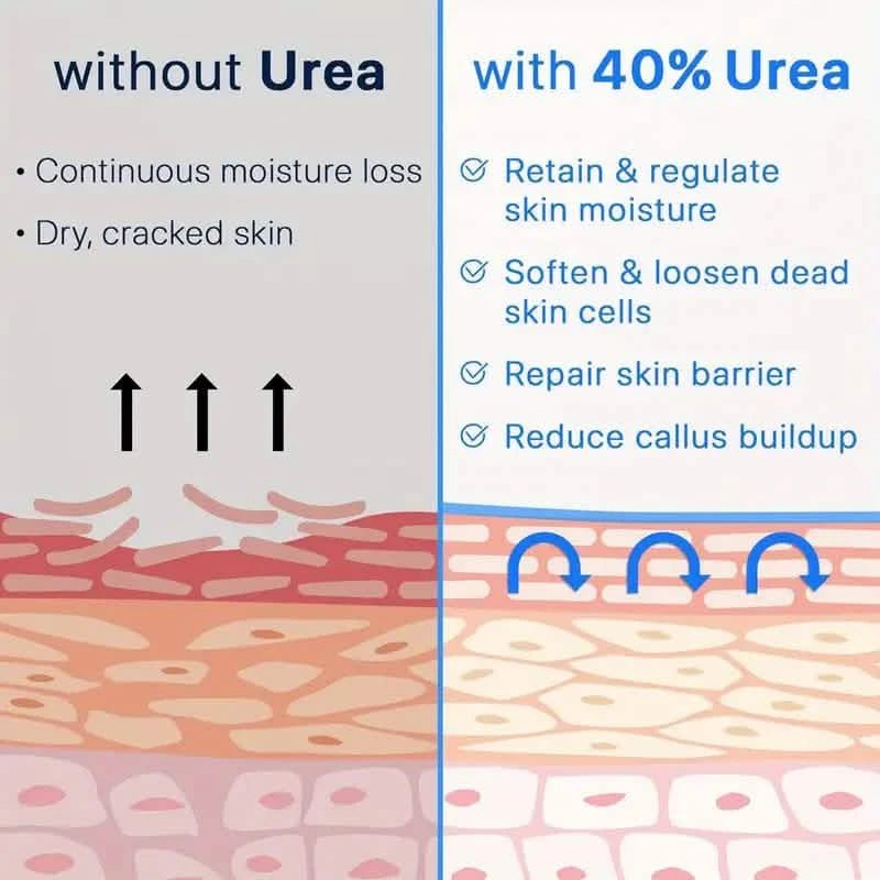 Trstay Foot Care Cream50g/ Foot Care Cream 40 Urea And Salicylic Acid Beauty & Personal Care - DailySale