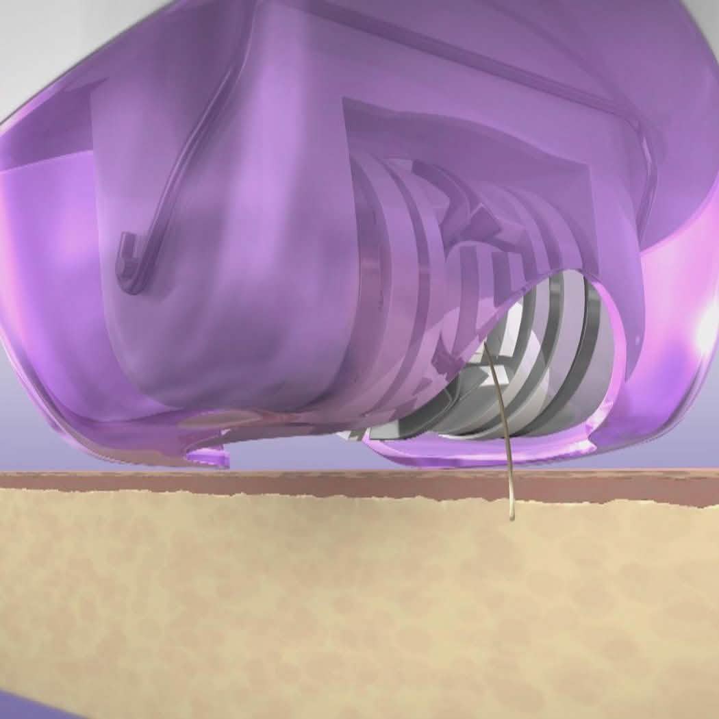 2-Pack: Epi Smooth Hair Removal System Beauty & Personal Care - DailySale