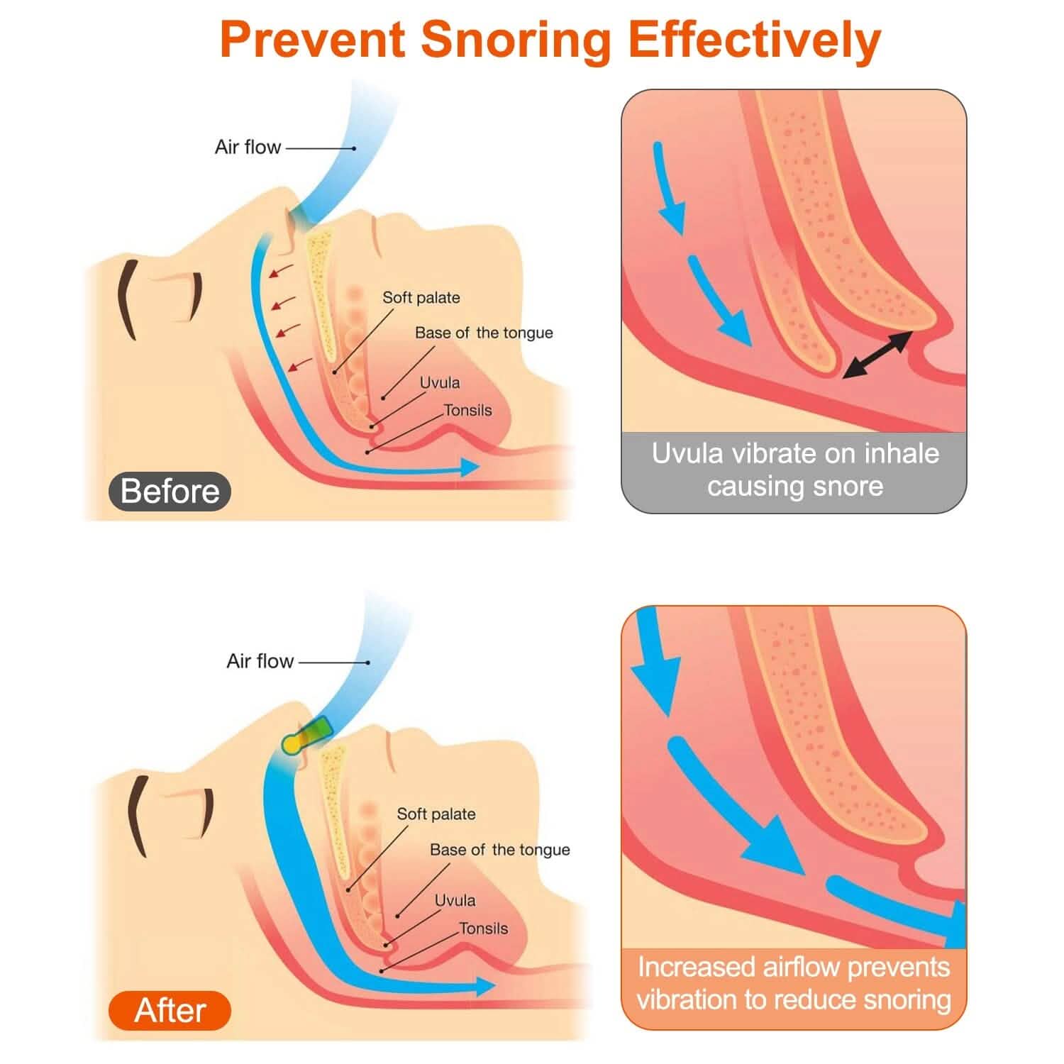 4-Pieces: Magnetic Nose Clip Anti Snoring Device Wellness - DailySale