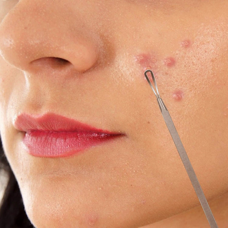 7-Pieces: Blackhead Remover Stainless Steel Beauty & Personal Care - DailySale