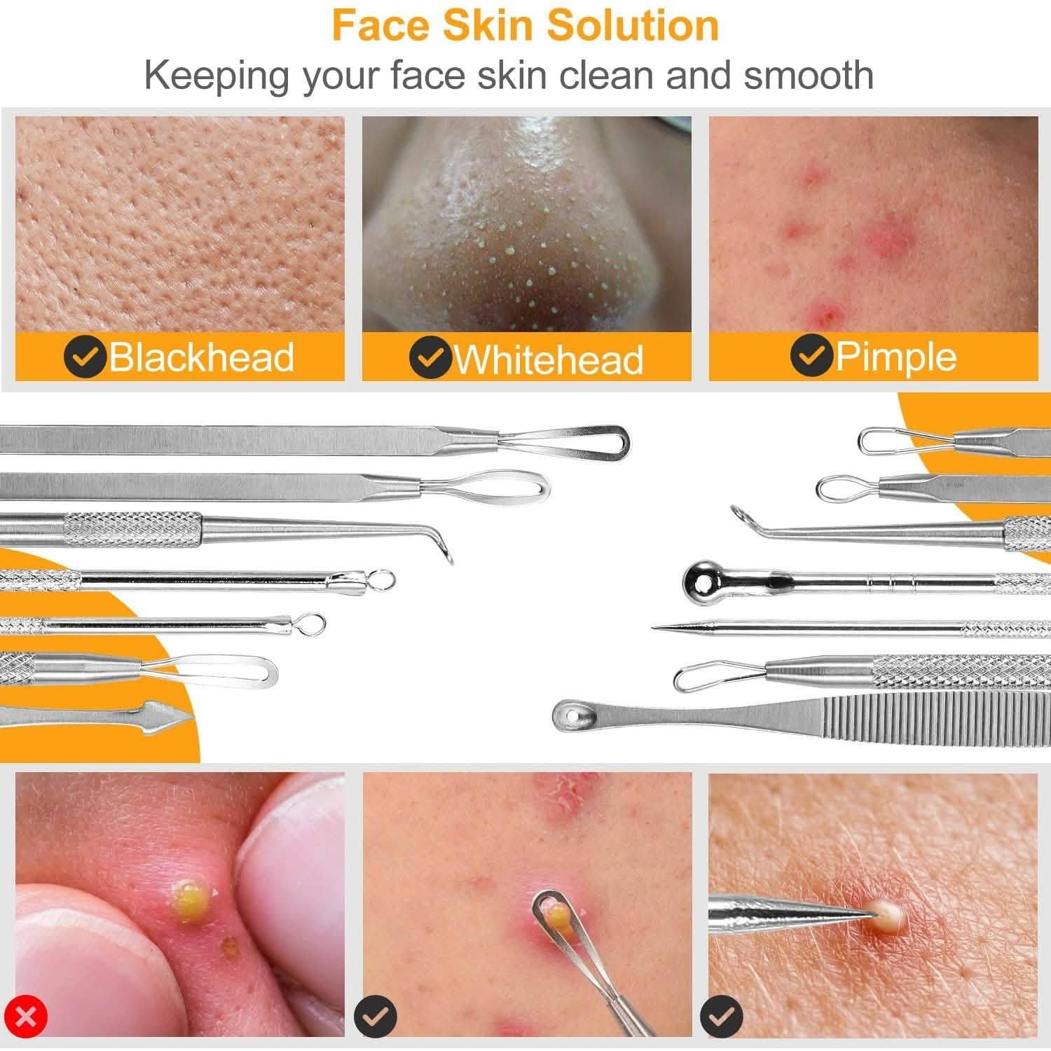 7-Pieces: Blackhead Remover Stainless Steel Beauty & Personal Care - DailySale