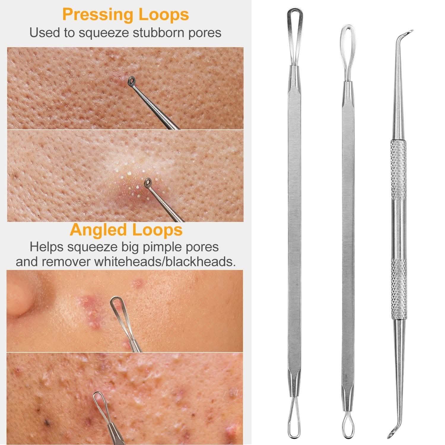 7-Pieces: Blackhead Remover Stainless Steel Beauty & Personal Care - DailySale