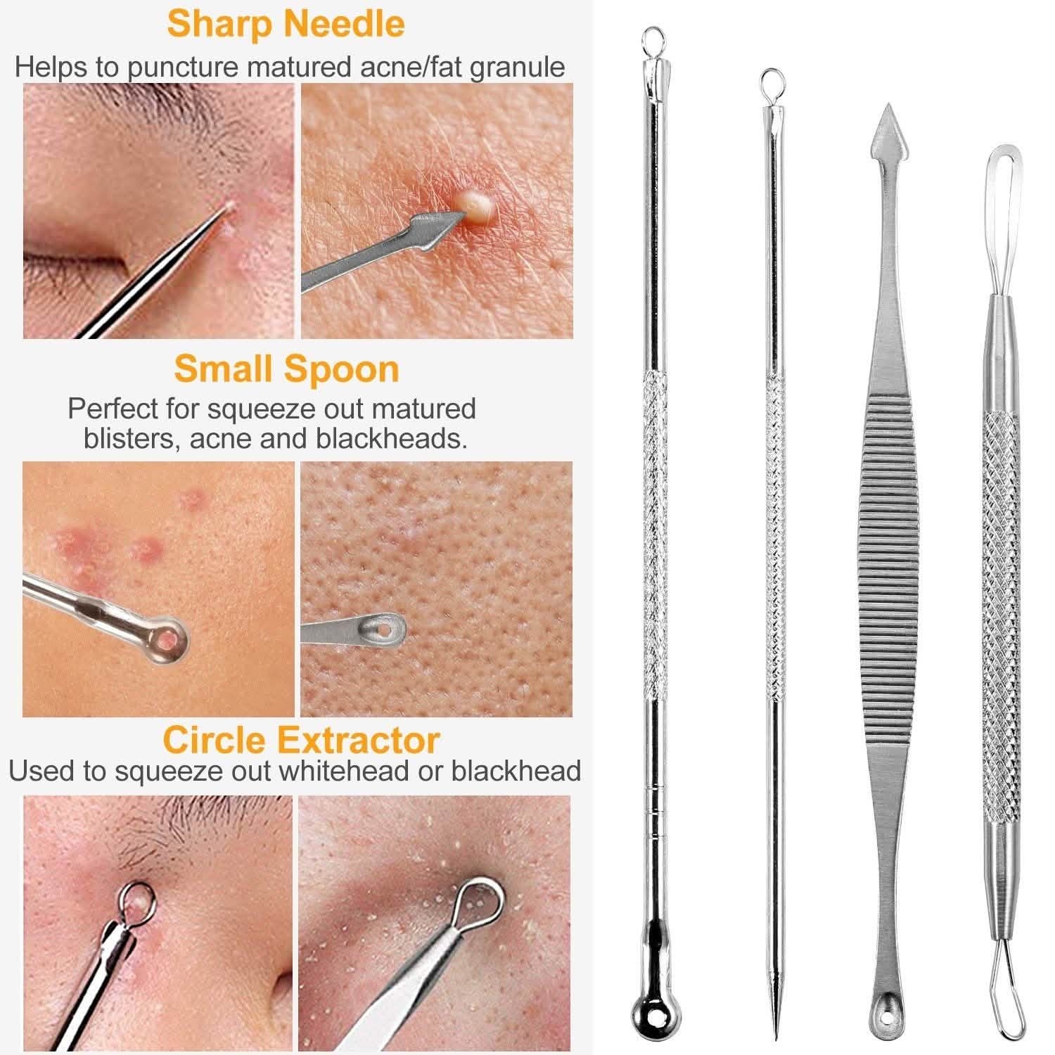 7-Pieces: Blackhead Remover Stainless Steel Beauty & Personal Care - DailySale