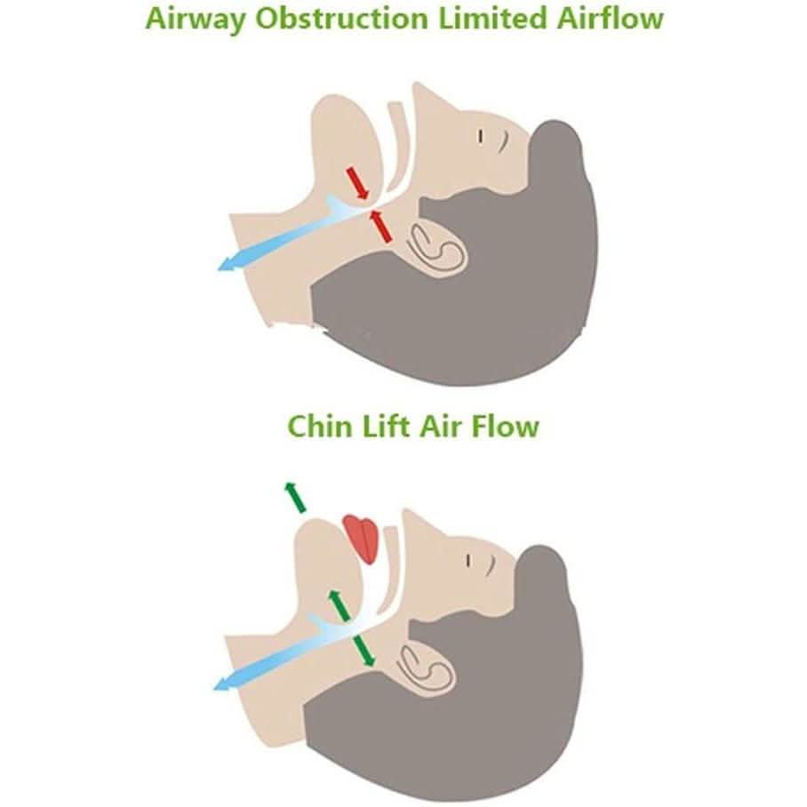 Anti Snoring Devices Chin Strap - Assorted Sizes Wellness & Fitness - DailySale