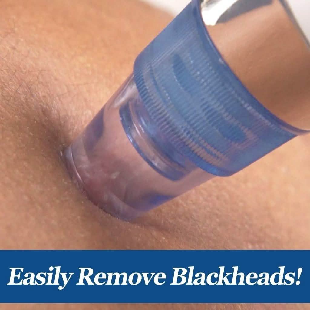 DermaSuction Blackhead Remover Beauty & Personal Care - DailySale