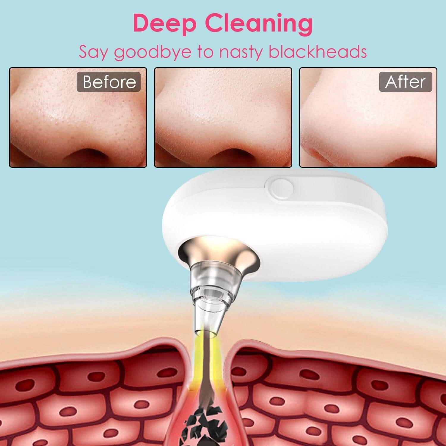 Electric Blackhead Comedone Extractor Tool Facial Pore Cleaner Beauty & Personal Care - DailySale