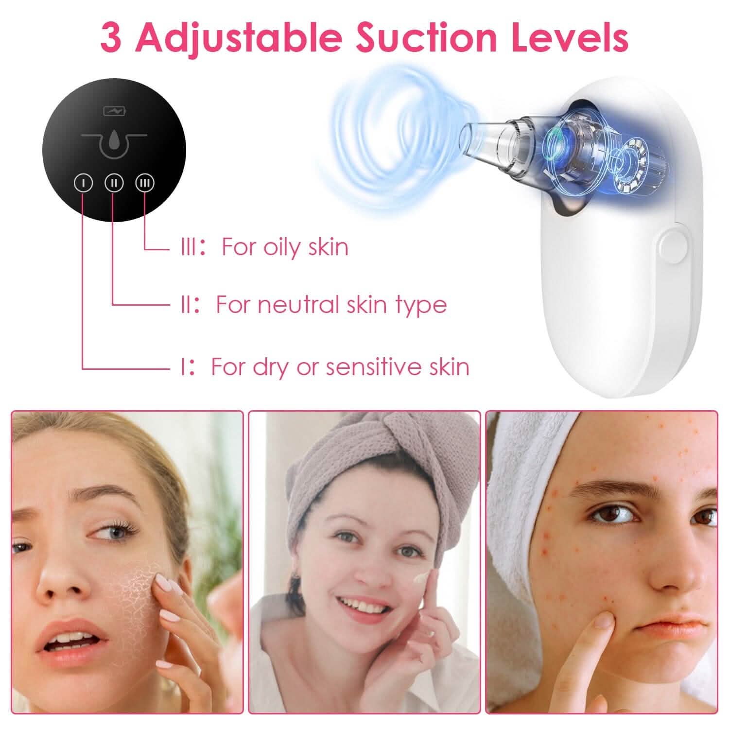 Electric Blackhead Comedone Extractor Tool Facial Pore Cleaner Beauty & Personal Care - DailySale