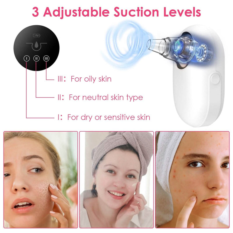 Electric Blackhead Comedone Extractor Tool Facial Pore Cleaner Beauty & Personal Care - DailySale