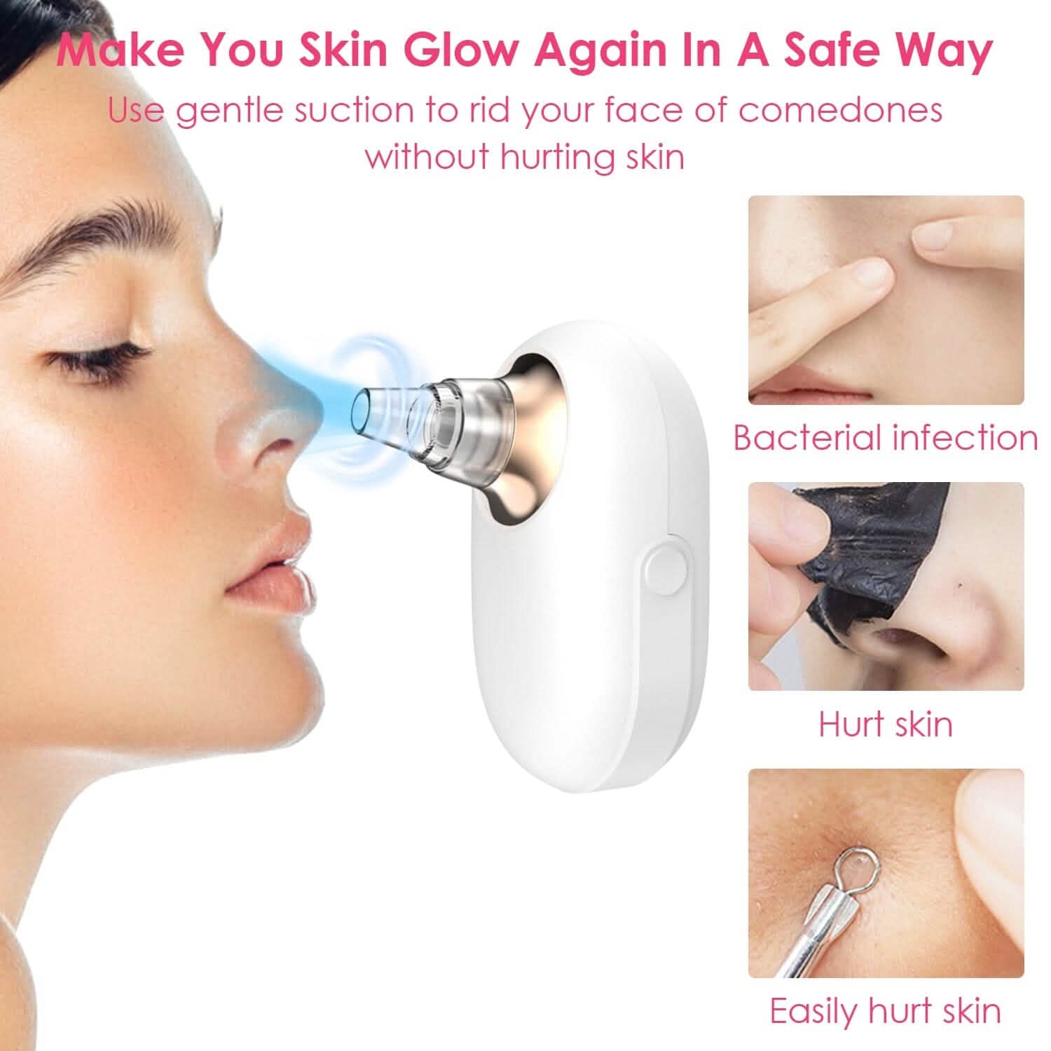 Electric Blackhead Comedone Extractor Tool Facial Pore Cleaner Beauty & Personal Care - DailySale