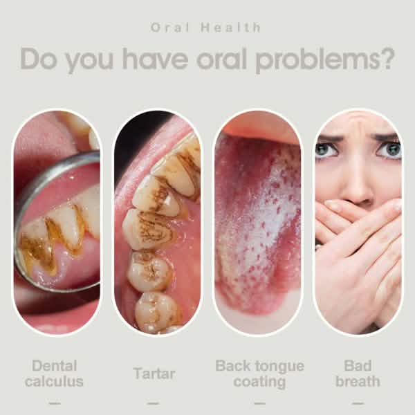 Electric Dental Scaler Vibration Tooth Calculus Remover Beauty & Personal Care - DailySale