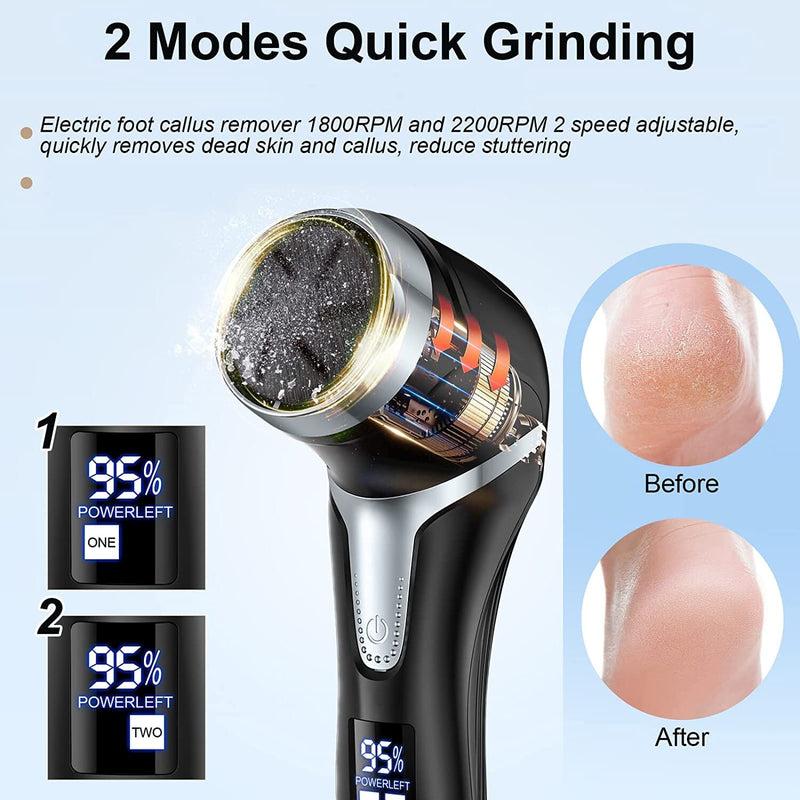 Electric Foot Callus Remover with Vacuum Cleaner Beauty & Personal Care - DailySale