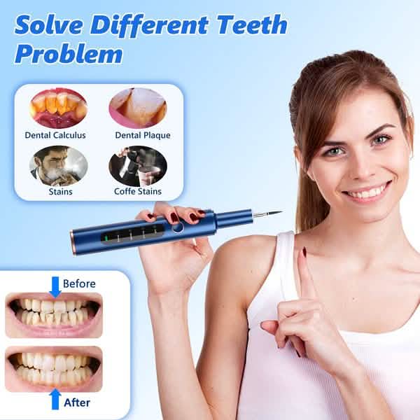 Electric Plaque Remover for Teeth, Rechargeable Teeth Cleaning Kit with 4 Modes Beauty & Personal Care - DailySale