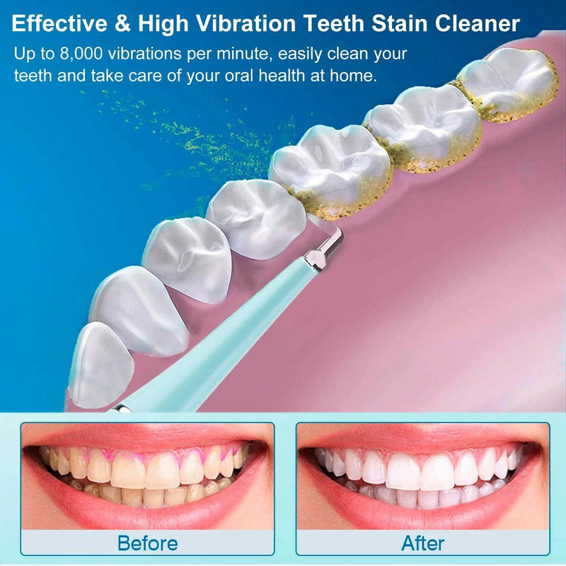 Electric Tartar Remover For Teeth Beauty & Personal Care - DailySale