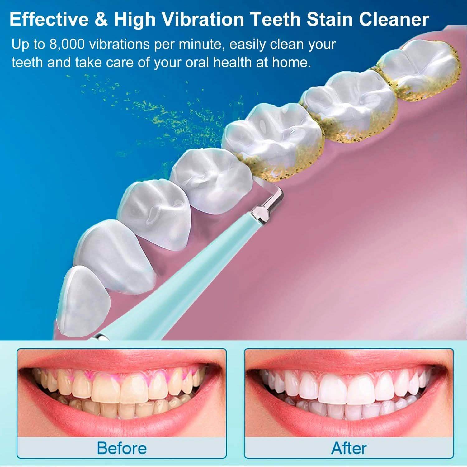 Electric Tartar Remover For Teeth Beauty & Personal Care - DailySale
