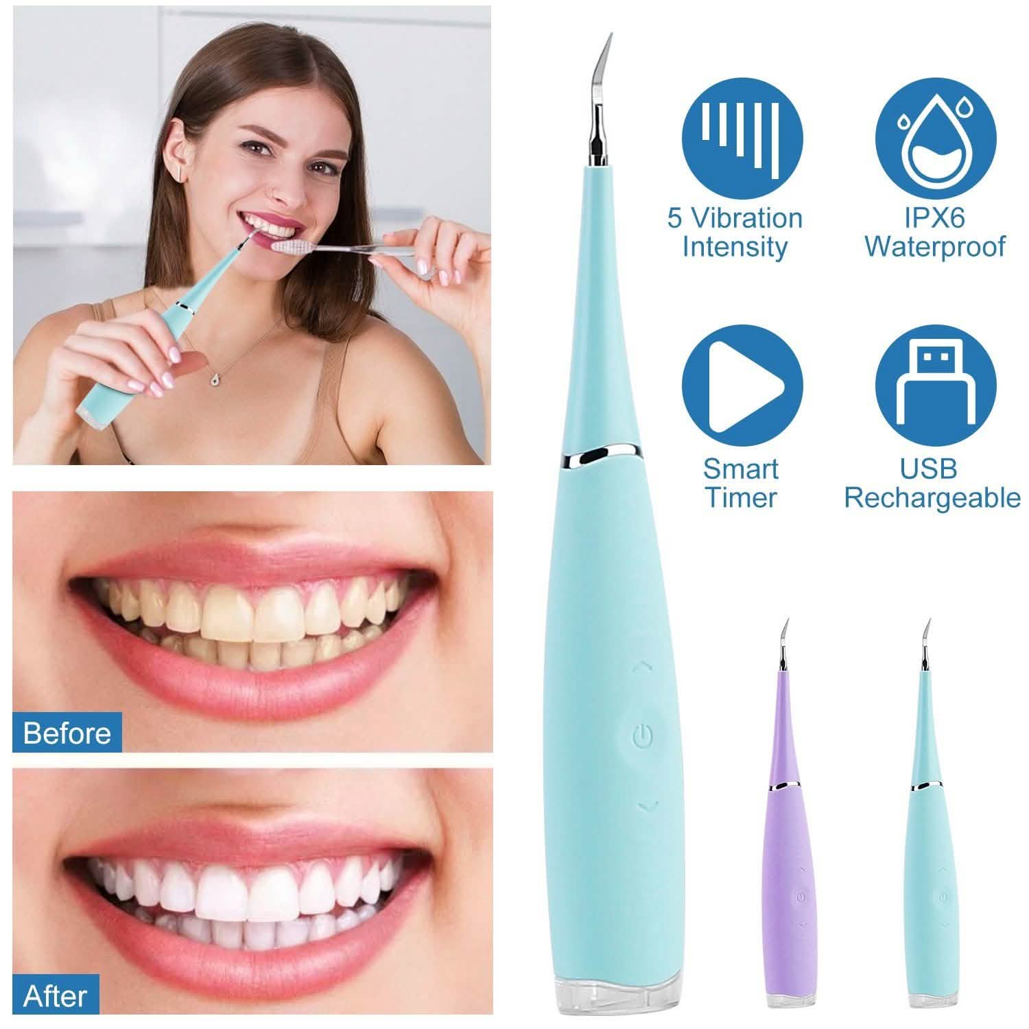 Electric Tartar Remover For Teeth Beauty & Personal Care - DailySale