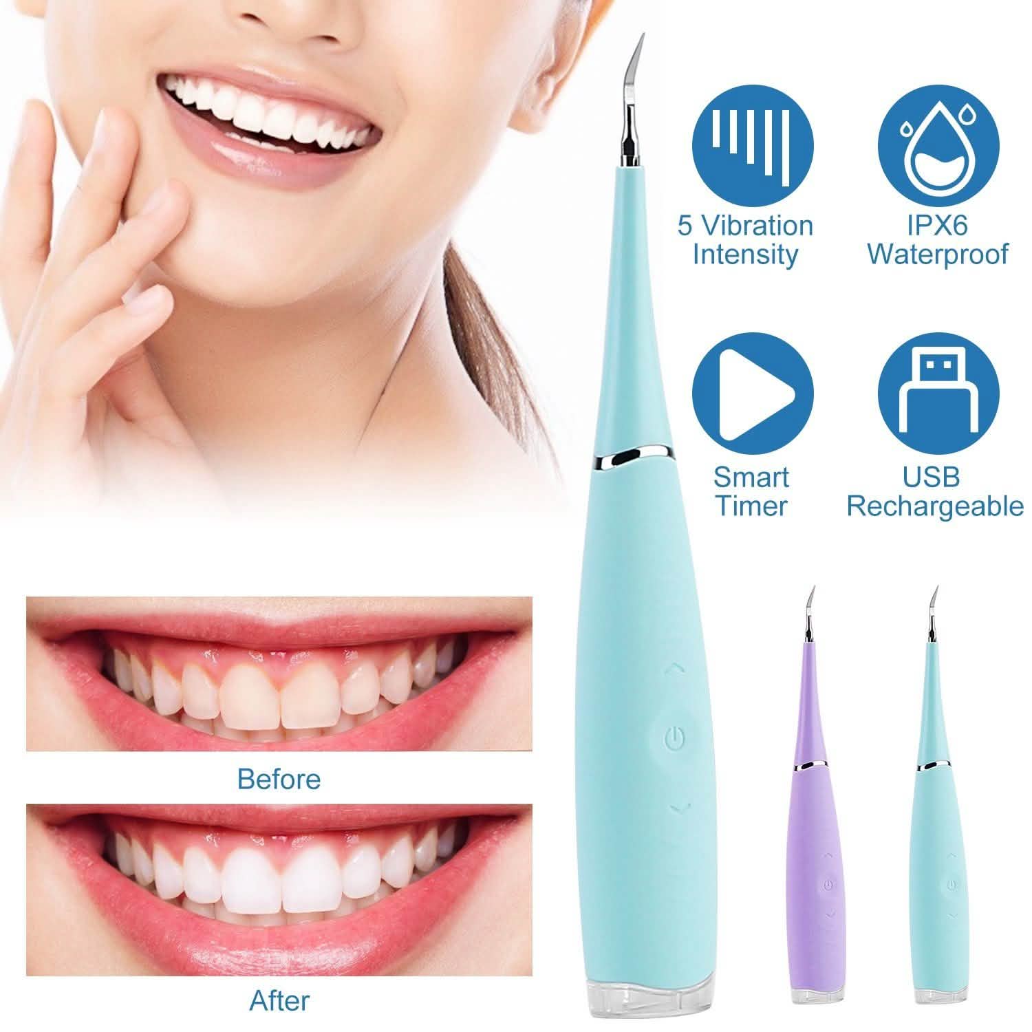 Electric Tartar Remover For Teeth Beauty & Personal Care - DailySale