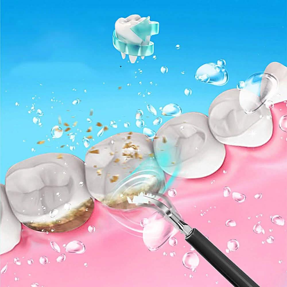 Electric Ultrasonic Dental Scaler Beauty & Personal Care - DailySale