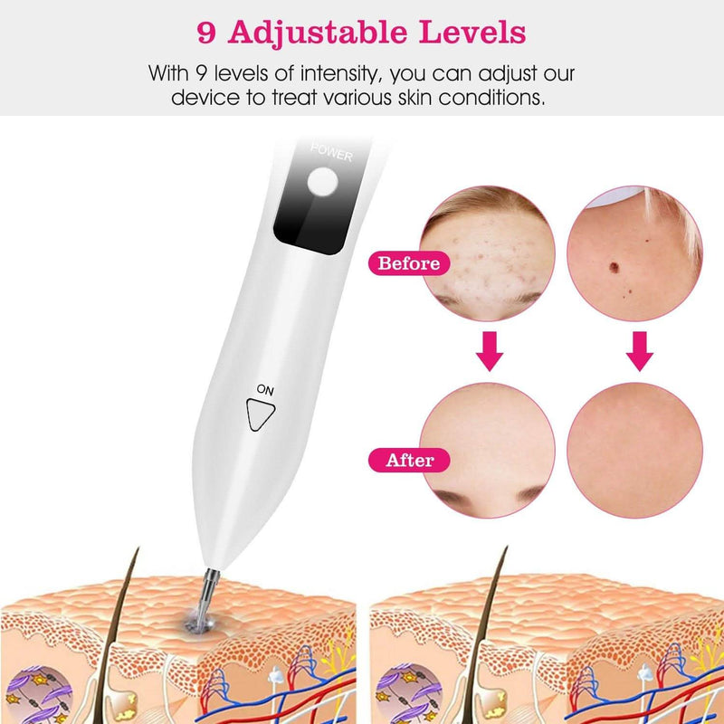 Portable Skin Tag Repair Kit with 6 Replaceable Needles Beauty & Personal Care - DailySale
