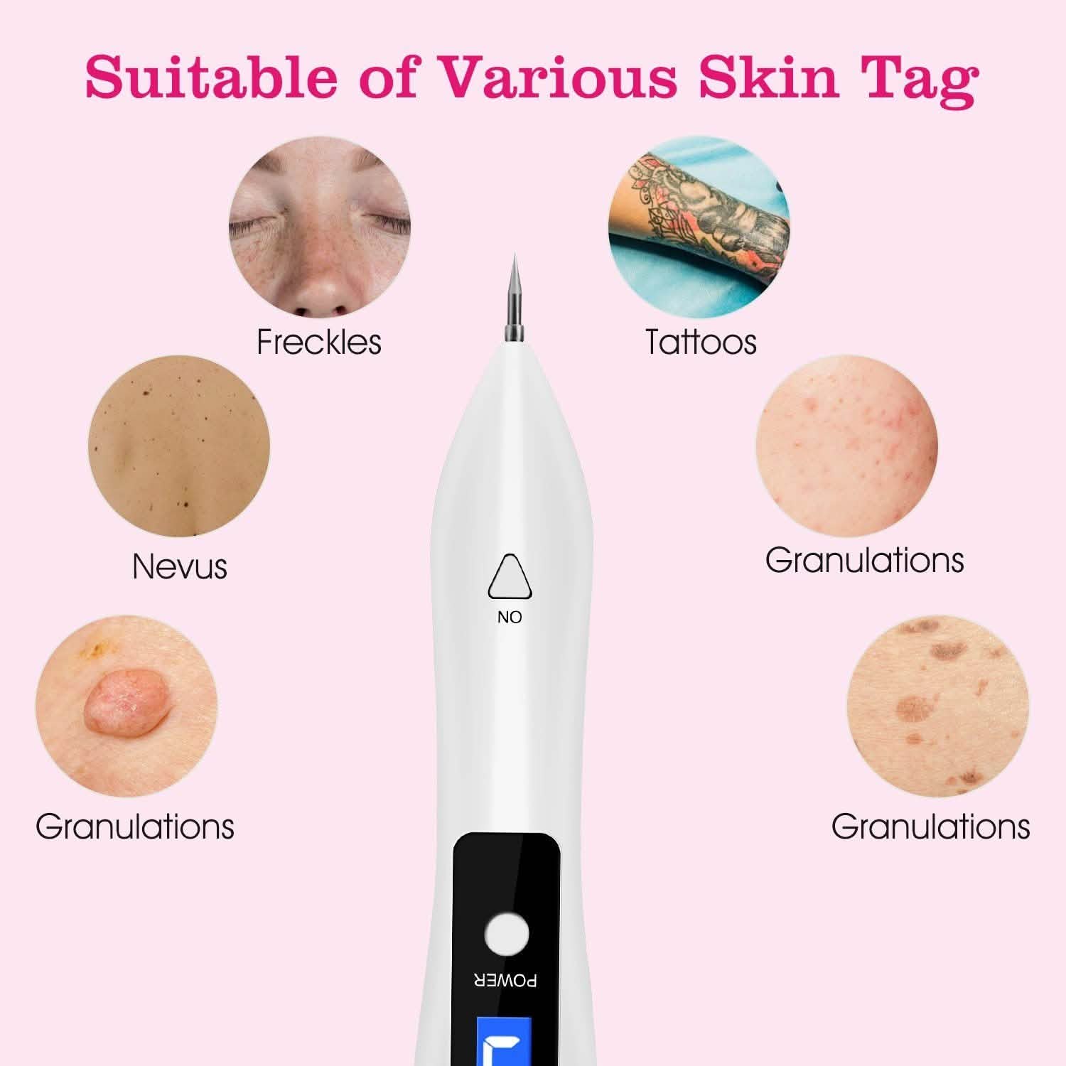 Portable Skin Tag Repair Kit with 6 Replaceable Needles Beauty & Personal Care - DailySale