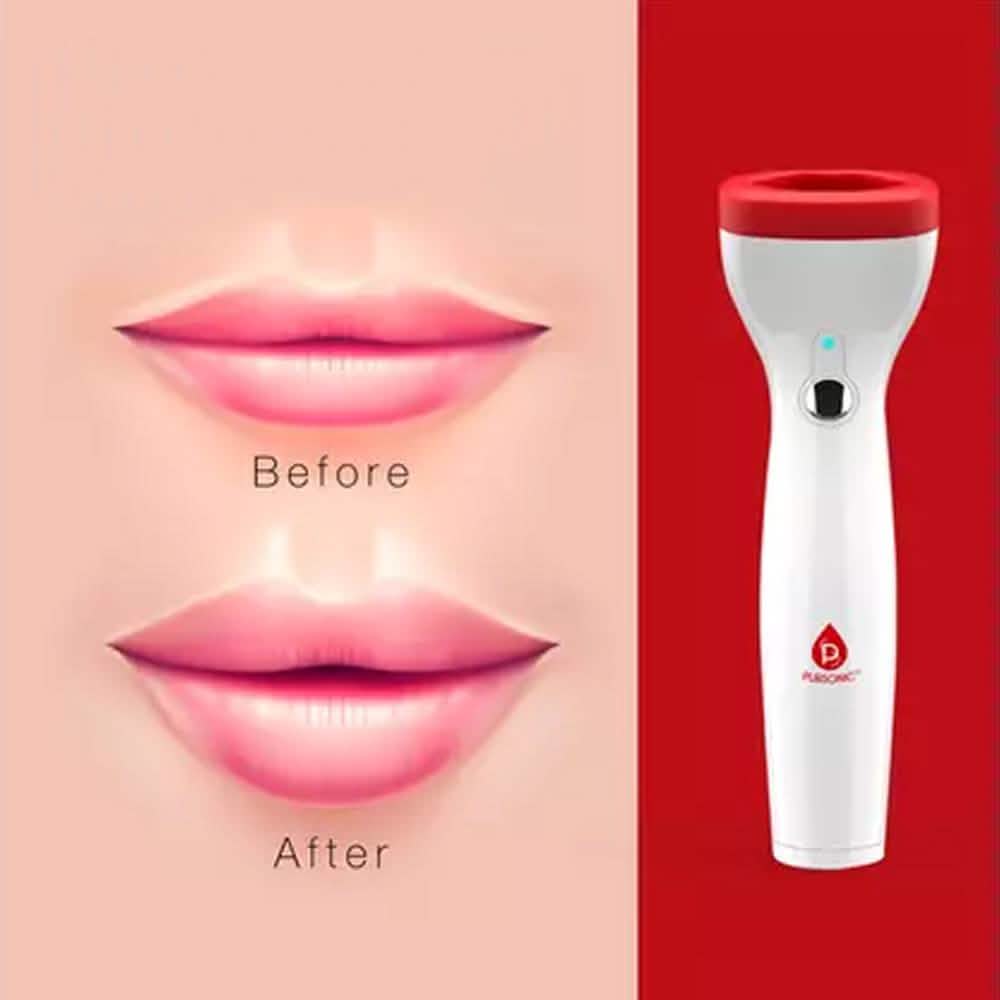 Pursonic Premium Automatic Fuller Lip Plumper Beauty & Personal Care - DailySale