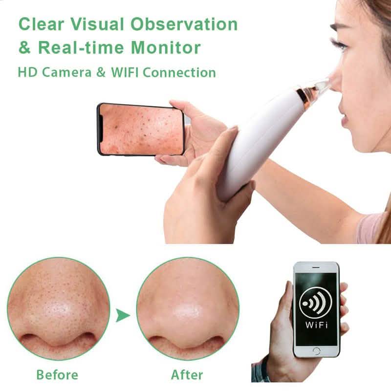 Visual Pore Cleaning Vacuum with Built in Camera Beauty & Personal Care - DailySale