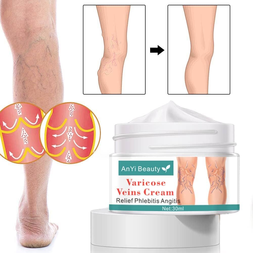 AnYi Beauty Varicose Vein Cream, Deep Nourishing Soothing Cream For Leg Beauty & Personal Care - DailySale