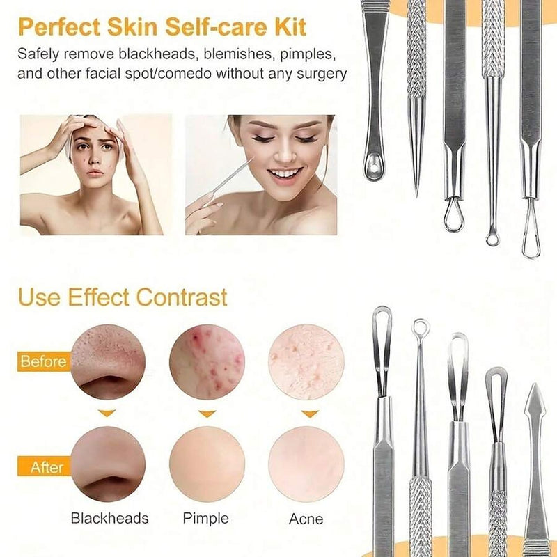 Guide to blackheads, pimples and acne