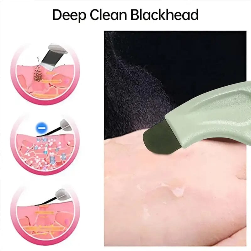 Blackhead Remover Tool Extractor Beauty & Personal Care - DailySale