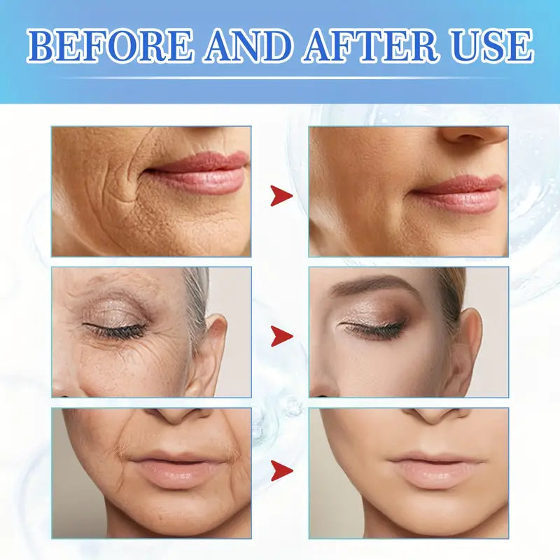 Intensive Anti Aging Botox Facial Serum - Plumps, Firms, Smooths Fine Lines and Wrinkles