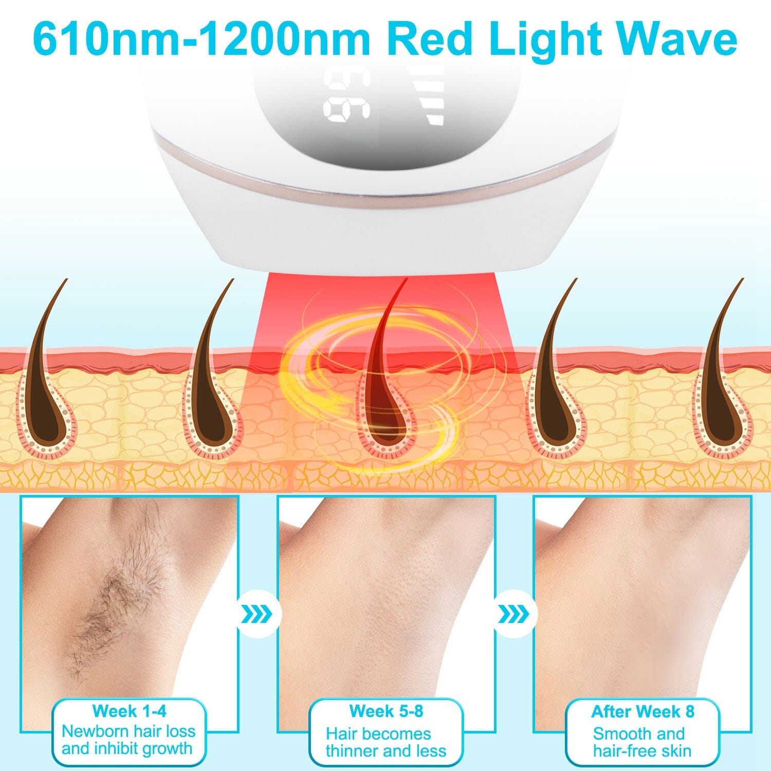 Laser Hair Removal Ice Cooling Permanent IPL Beauty & Personal Care - DailySale