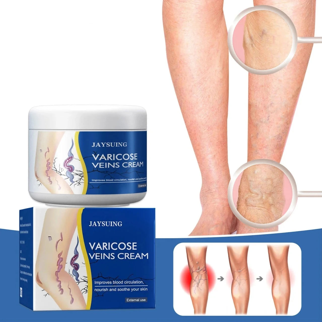 Pain Relief Leg Spider Veins Vasculitis Promote Circulation Smooth Metabolism 30g Exfoliation Beauty & Personal Care - DailySale