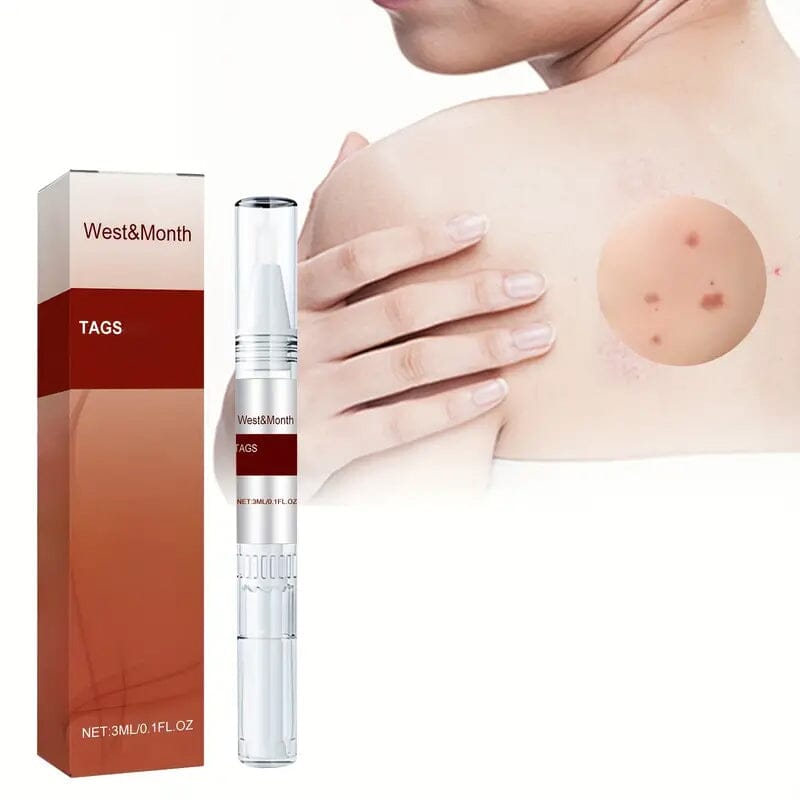 Skin Tag Removal Pen Beauty & Personal Care - DailySale