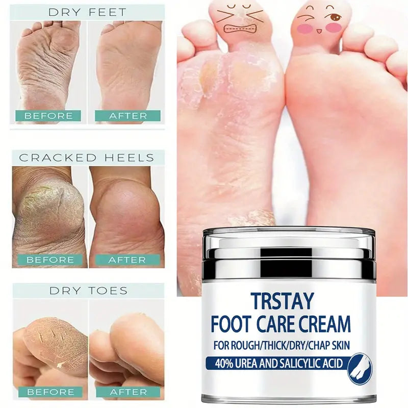 Trstay Foot Care Cream50g/ Foot Care Cream 40 Urea And Salicylic Acid Beauty & Personal Care - DailySale