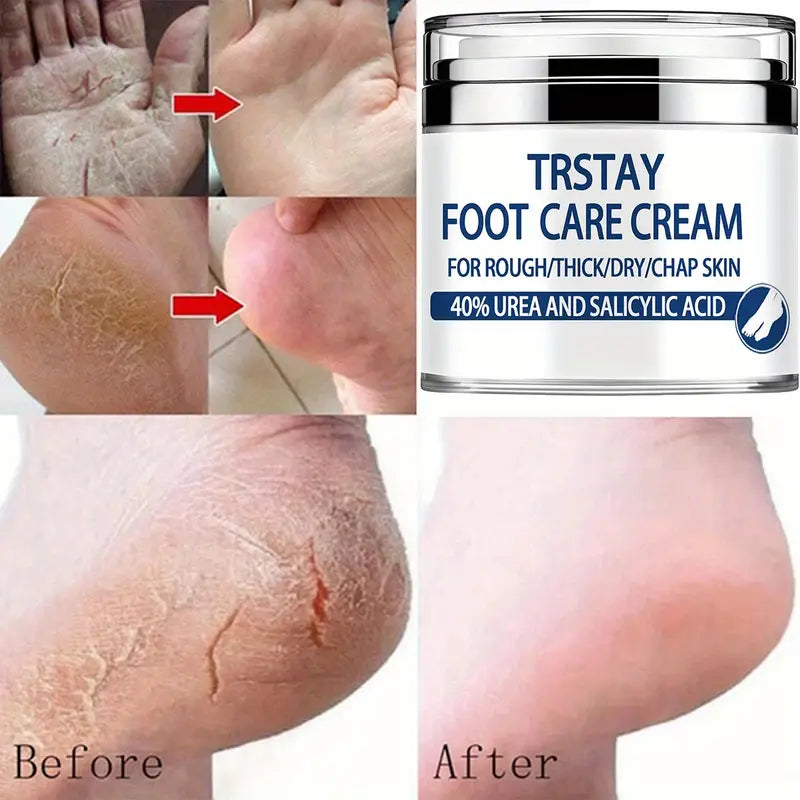 Trstay Foot Care Cream50g/ Foot Care Cream 40 Urea And Salicylic Acid Beauty & Personal Care - DailySale