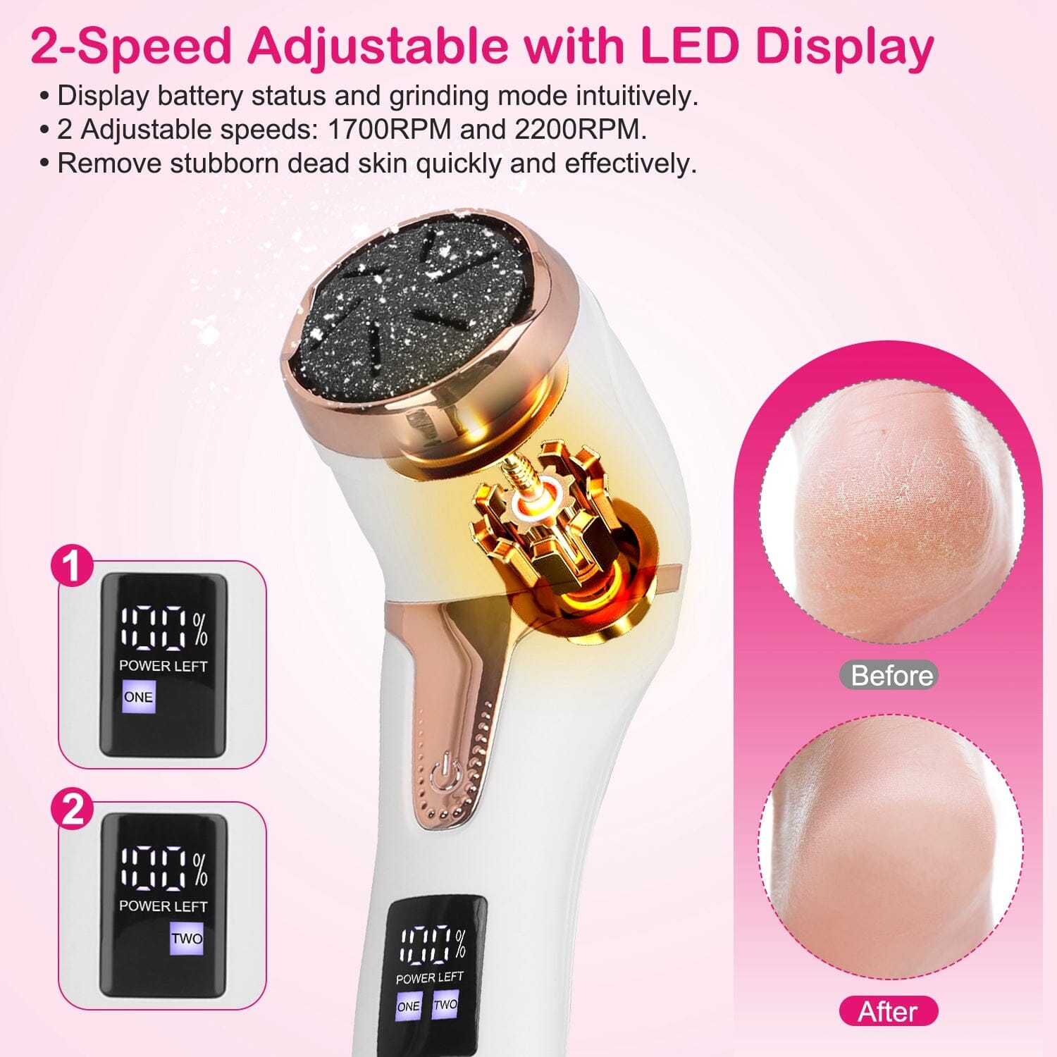 17-Pieces Set: Electric Foot Callus Remover with Vacuum Foot Grinder Rechargeable Beauty & Personal Care - DailySale