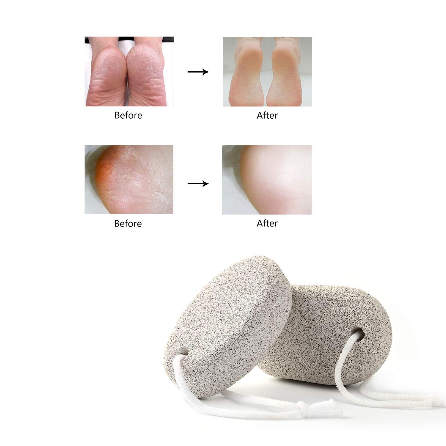 2-Pieces: Natural Pumice Stone Bath - DailySale