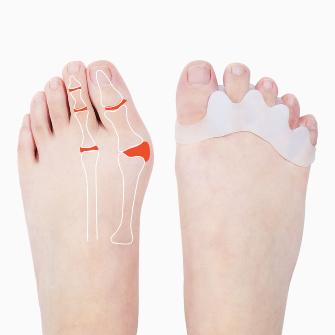 4-Pack: Toe Separator Bunion Toe Spacer for Overlapping Hammer Toe Wellness - DailySale