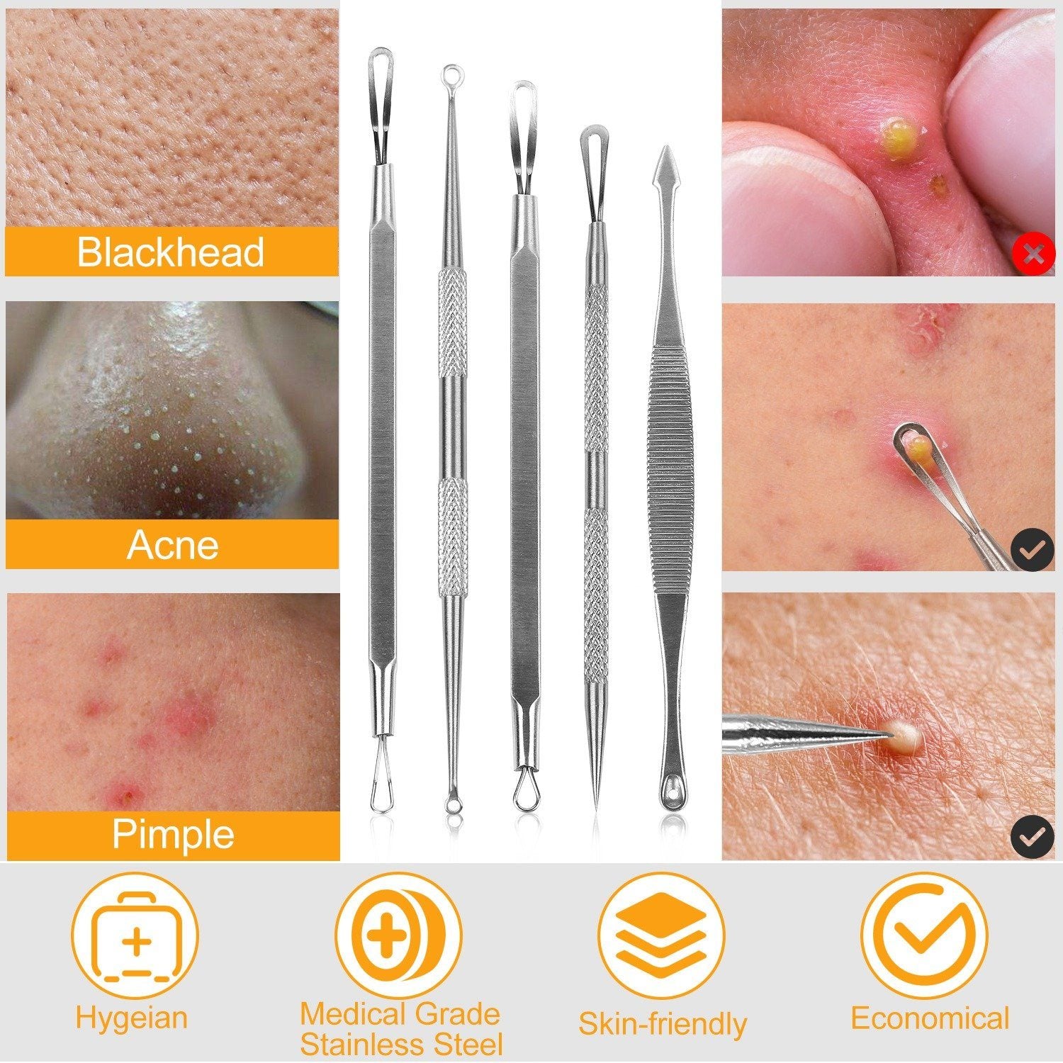 5-Pieces Set: BlackHead Remover Kit Pimple Comedone Extractor Tool Set Beauty & Personal Care - DailySale