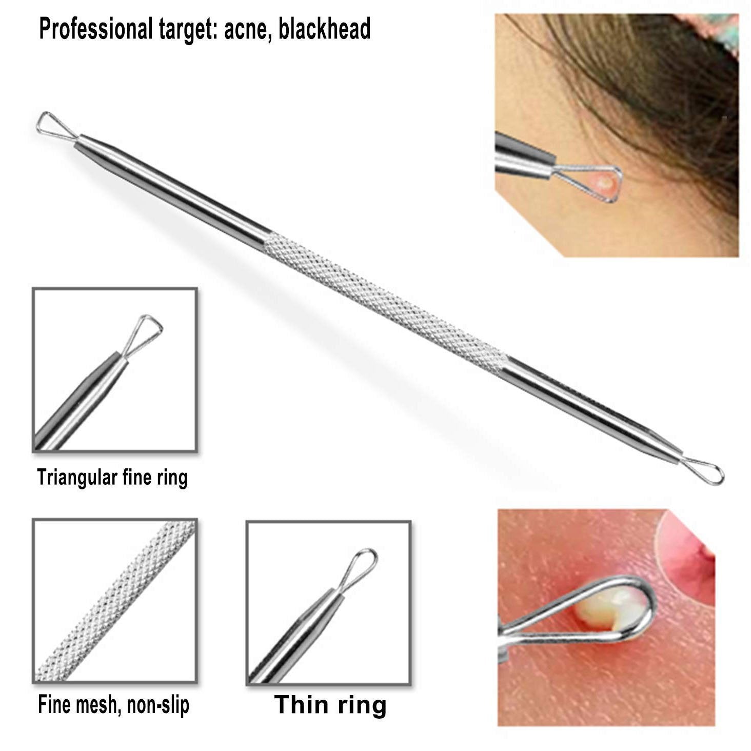 6-Pieces Set: Blackhead Remover Comedones Extractor Acne Removal Kit Beauty & Personal Care - DailySale