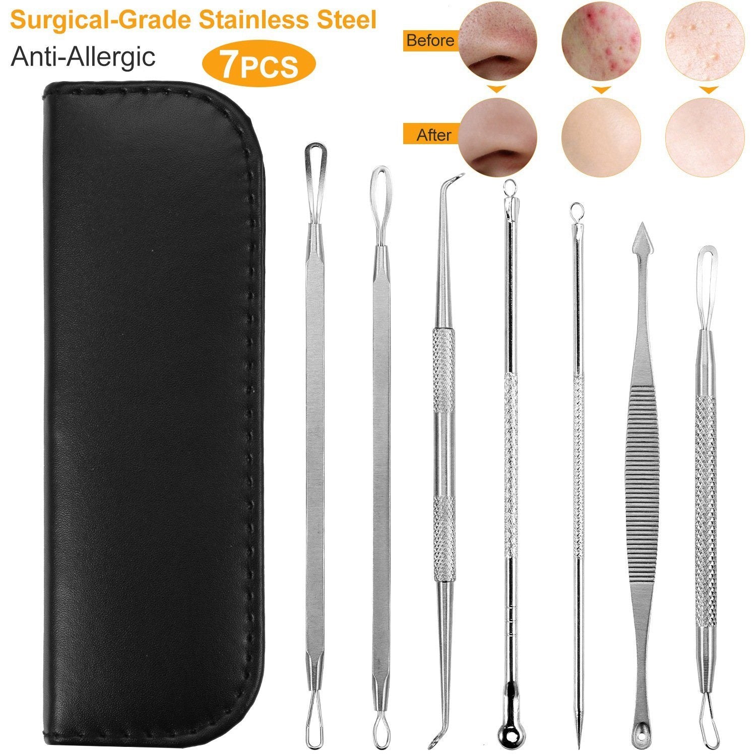 7-Pieces: Blackhead Remover Stainless Steel Beauty & Personal Care - DailySale